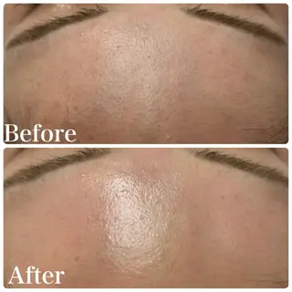 LAKI eye&face  studio所属・LAKI studioのエステ・リラクイメージ