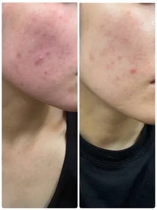 CEサロンbelle mona所属・CEサロン belle monaのエステ・リラクイメージ