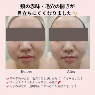 PRETTIEST SHINE所属・フェイシャル/ボディ /ブライダル山田浩子のエステ・リラクイメージ