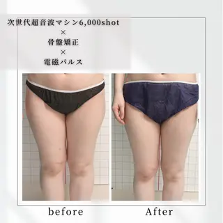 小顔矯正専門店 【RED】池田のエステ・リラクイメージ