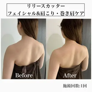 堀之内宏次 ［美容鍼灸師］のエステ・リラクイメージ