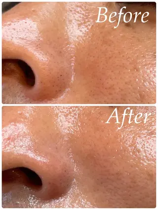 春日井/脱毛・エステサロン salon de AZURE所属・salon de AZUREのエステ・リラクイメージ