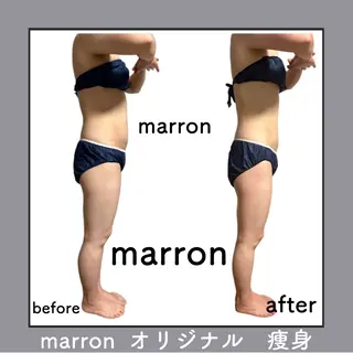 marron所属・痩身ハイパーナイフ ララピールリアボーテのエステ・リラクイメージ