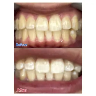 MBEAUTYSALON 千葉店・京成大久保所属・Melty 輝のその他イメージ