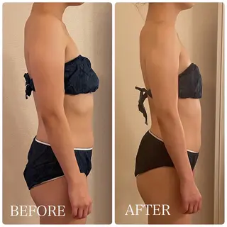 痩身小顔IRISER Akiのエステ・リラクイメージ