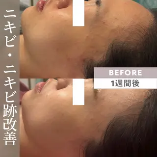 小顔矯正専門店 【RED】池田のエステ・リラクイメージ