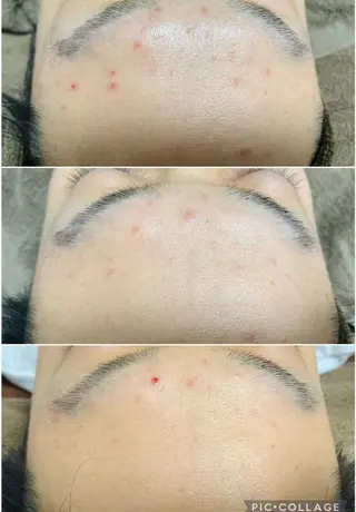 ロング カラー パーマ ヘアアレンジ メンズ キッズ ネイル マツエク・マツパ アイブロウ 肌質体質を変えて すっぴん肌にのエステ・リラクイメージ