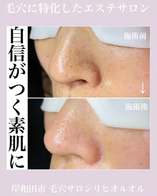 毛穴汚れ改善専門店/ 岸和田/リヒオルオルのエステ・リラクイメージ
