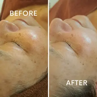 鍼灸サロンmiyabi所属・美容鍼×エステ　鍼灸 サロンmiyabiのエステ・リラクイメージ