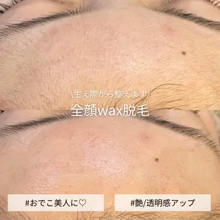 EST BEAUTY所属・顔ワックス脱毛/ ハーブピーリングのエステ・リラクイメージ