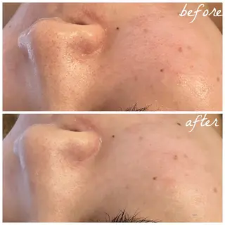 メンズ メナード岐阜市茜部 杉浦のエステ・リラクイメージ