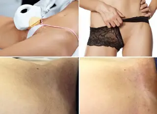 顔脱毛＆毛穴＆ニキビ 優良№1♪ヒロコ♪のエステ・リラクイメージ