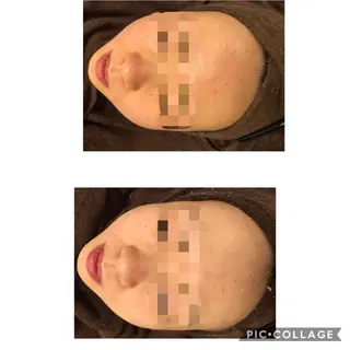 セミロング カラー パーマ ヘアアレンジ キッズ ネイル マツエク・マツパ アニメ,Vオタク× 即効痩せエステサロンのエステ・リラクイメージ