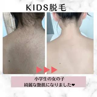 キッズ Bemott 日進のエステ・リラクイメージ