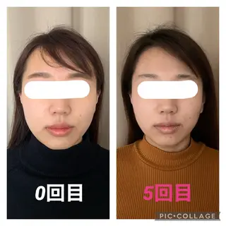 インタークロス所属・小顔矯正専門TIAM インタークロス池袋店のエステ・リラクイメージ