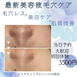 🌿小顔・痩身・脱毛 レイビス川崎店🌿のエステ・リラクイメージ