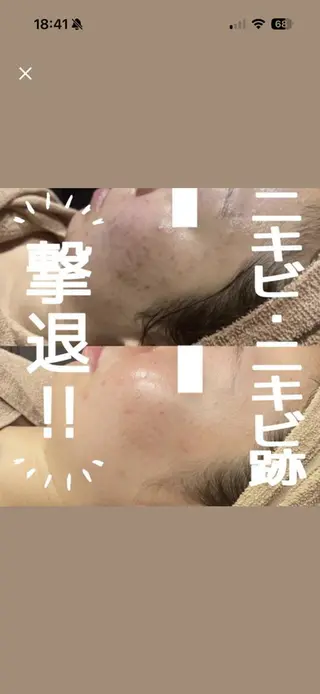 レイビス盛岡店 ♥佐藤♥のエステ・リラクイメージ