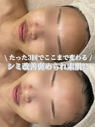 大阪/高槻　salon me.所属・仲原 杏菜のエステ・リラクイメージ