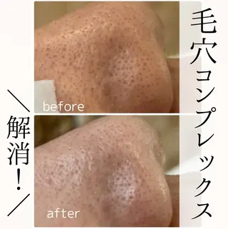 小顔・毛穴・たるみ ネイル　似内真樹のエステ・リラクイメージ