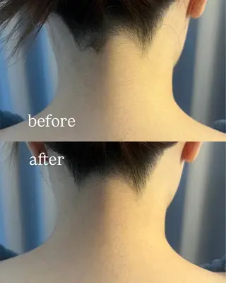 うなじ脱毛/美肌脱毛 LABELのエステ・リラクイメージ