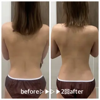 salon ace所属・【小顔矯正】 salonaceのエステ・リラクイメージ