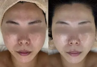 MAILE-マイレ-BEAUTY SALON所属・MAILE-マイレ- NARUMIのエステ・リラクイメージ