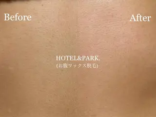 HOTEL&PARK . ワックス脱毛のエステ・リラクイメージ