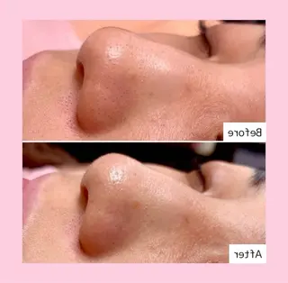 韓国肌管理専門店 White labo 宝塚店所属・有川 凜のエステ・リラクイメージ