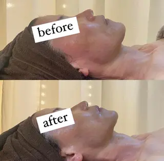 BELCIA福岡店　récolte de BELCIA（レコルトデベルシア）所属・BELCIA福岡店 レコルトデベルシアのエステ・リラクイメージ