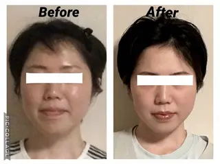 小顔矯正Sho  FaceDesignのエステ・リラクイメージ