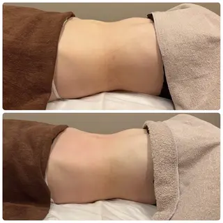 美肌脱毛サロン muroのエステ・リラクイメージ