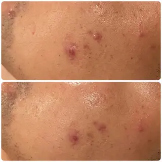 立体小顔×艶肌×美ボ ディ似合わせ施術 岡のエステ・リラクイメージ