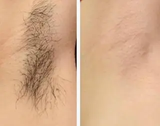 Bell Tree すずきのエステ・リラクイメージ