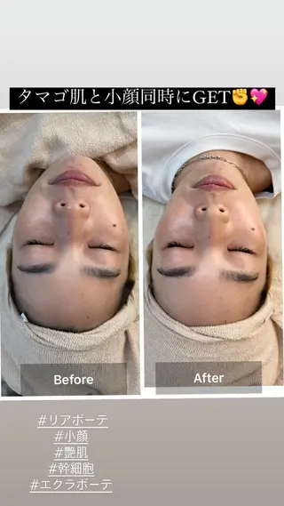 MARIRE EPISALONのエステ・リラクイメージ