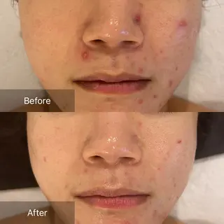 mine.mマインエム所属・mine.mi マインエムのエステ・リラクイメージ