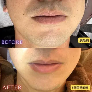 メンズ 都度払い専門　脱毛サロンHYGIENE BEAUTY ROOM 19B 仙台駅前東口店所属・脱毛サロン 19B(毛利)のエステ・リラクイメージ