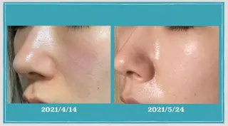 pllia beautyのネイルデザイン