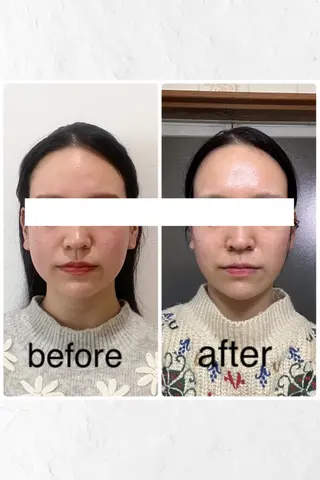 小顔と ヘッドスパのお店のエステ・リラクイメージ