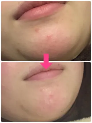 カラー パーマ ヘアアレンジ メンズ キッズ ネイル マツエク・マツパ ‍痩身＆ボディ 結果出し🌟丹野のエステ・リラクイメージ