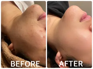 ハーブピーリング 横浜のエステ・リラクイメージ