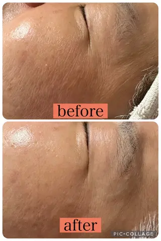 EPIL 宮本のエステ・リラクイメージ