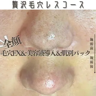 Muqu.所属・Muqu. 毛穴サロンのエステ・リラクイメージ