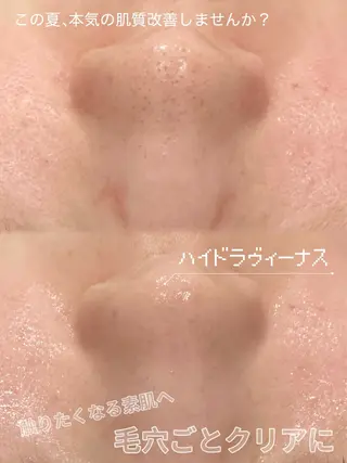 姫路　Unknown所属・Unknown.姫路 いさと🍓のマツエク・マツパデザイン