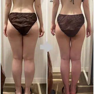 痩身脱毛専門店 Partirのエステ・リラクイメージ