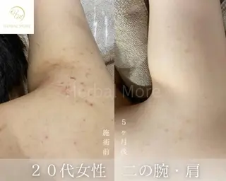 Grandir所属・ハーブピーリング専門 グランディール　武内のエステ・リラクイメージ