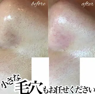 マツエク・マツパ 【しみ毛穴専門店】beautysalon Ankh所属・しみ毛穴専門店 Ankh 平田のエステ・リラクイメージ