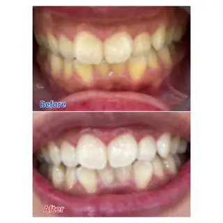 MBEAUTYSALON 千葉店・京成大久保所属・Melty 輝のその他イメージ