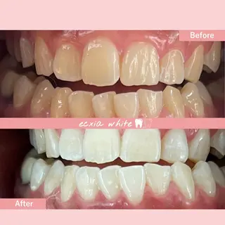 セルフホワイトニング エクシア中島公園店のその他イメージ