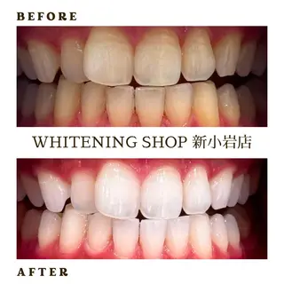 メンズ ホワイトニング ショップ新小岩店のその他イメージ