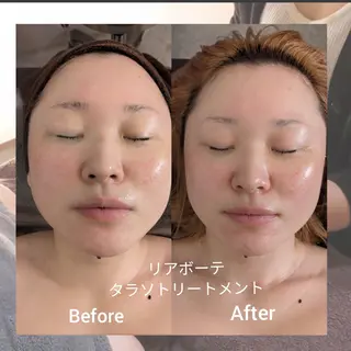 ﾌｪｲｼｬﾙｴｽﾃ ﾗﾄｩｰﾙ伊深のエステ・リラクイメージ